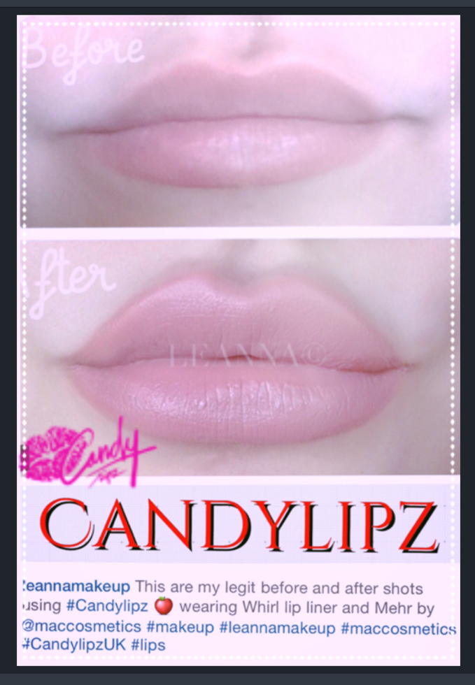 What is Cinderella Lips? - CandyLipz