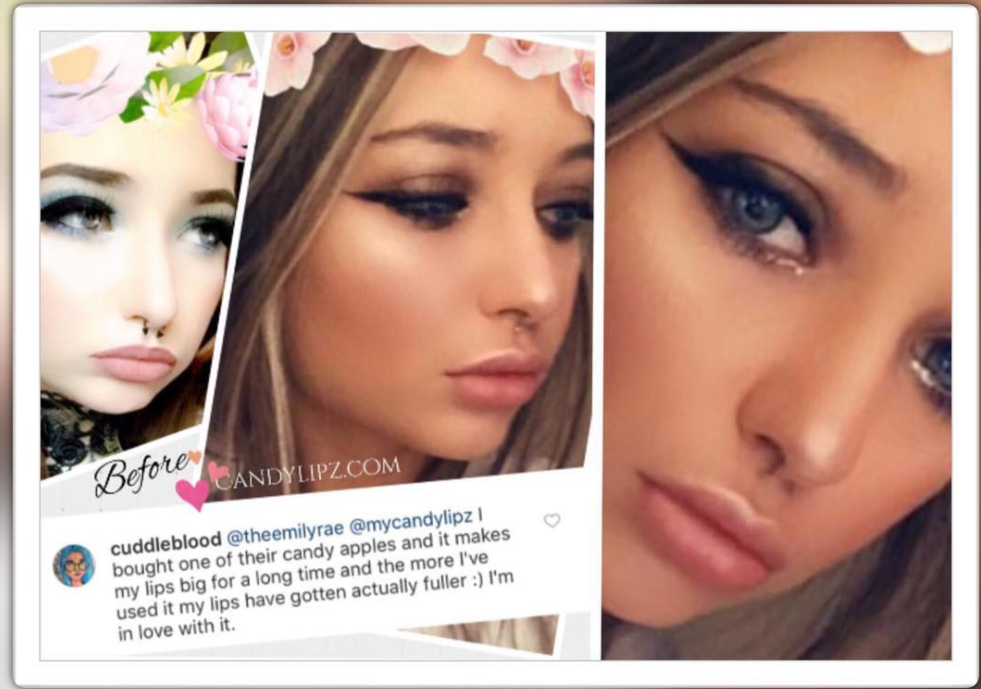 Best Lip Plumper Reviews